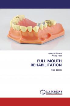 FULL MOUTH REHABILITATION
