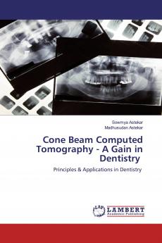 Cone Beam Computed Tomography - A Gain in Dentistry