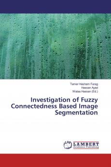 Investigation of Fuzzy Connectedness Based Image Segmentation