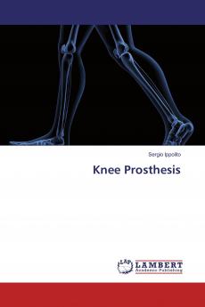 Knee Prosthesis