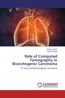Role of Computed Tomography in Bronchogenic Carcinoma