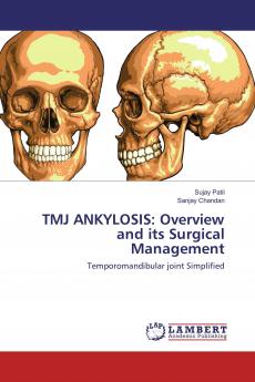 TMJ ANKYLOSIS: Overview and its Surgical Management