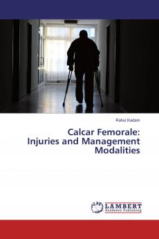 Calcar Femorale: Injuries and Management Modalities
