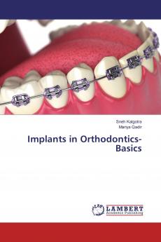Implants in Orthodontics- Basics