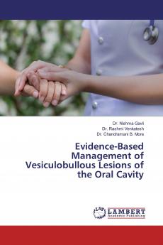 Evidence-Based Management of Vesiculobullous Lesions of the Oral Cavity