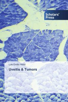 Uveitis & Tumors