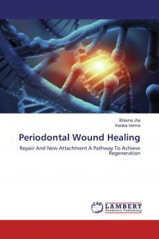 Periodontal Wound Healing