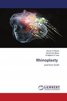 Rhinoplasty