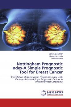 Nottingham Prognostic Index-A Simple Prognostic Tool for Breast Cancer