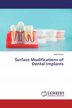 Surface Modifications of Dental Implants