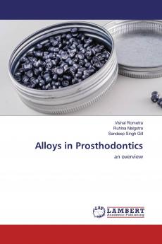 Alloys in Prosthodontics