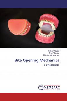 Bite Opening Mechanics