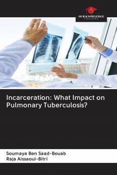Incarceration: What Impact on Pulmonary Tuberculosis?