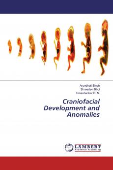 Craniofacial Development and Anomalies