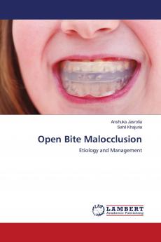 Open Bite Malocclusion
