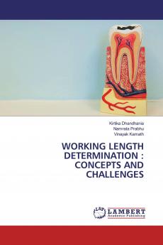 Working Length Determination