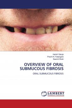 OVERVIEW OF ORAL SUBMUCOUS FIBROSIS