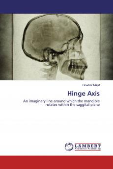 Hinge Axis
