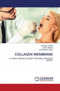 COLLAGEN MEMBRANE