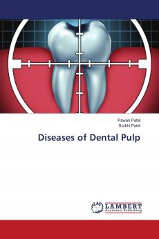 Diseases of Dental Pulp