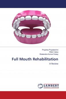Full Mouth Rehabilitation