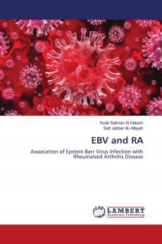 EBV and RA