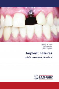 Implant Failures