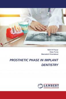 PROSTHETIC PHASE IN IMPLANT DENTISTRY