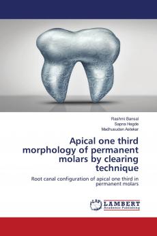 Apical one third morphology of permanent molars by clearing technique