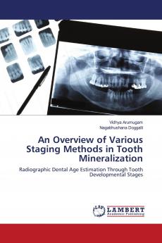 An Overview of Various Staging Methods in Tooth Mineralization