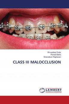 CLASS III MALOCCLUSION