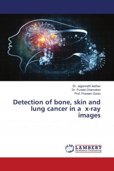 Detection of bone skin and lung cancer in a x-ray images