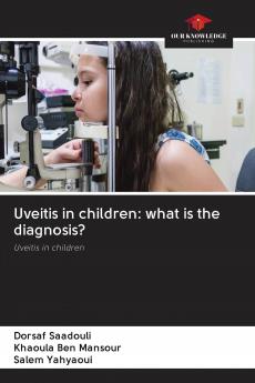 Uveitis in children: what is the diagnosis?