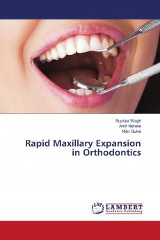 Rapid Maxillary Expansion in Orthodontics