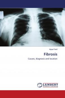 Fibrosis