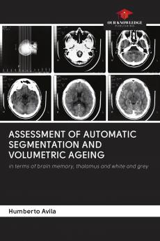 ASSESSMENT OF AUTOMATIC SEGMENTATION AND VOLUMETRIC AGEING