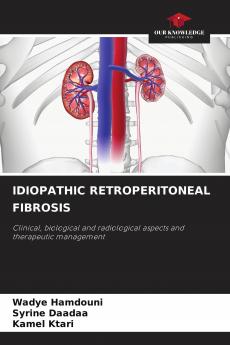 IDIOPATHIC RETROPERITONEAL FIBROSIS