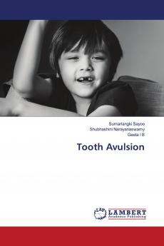 Tooth Avulsion