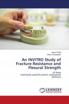 An INVITRO Study of Fracture Resistance and Flexural Strength