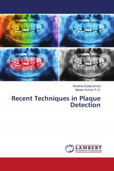 Recent Techniques in Plaque Detection