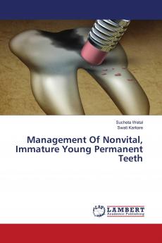 Management Of Nonvital Immature Young Permanent Teeth