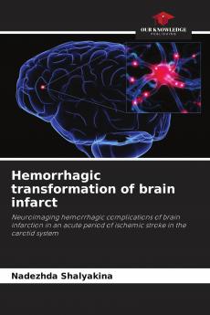Hemorrhagic transformation of brain infarct