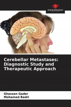 Cerebellar Metastases