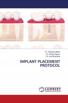 IMPLANT PLACEMENT PROTOCOL