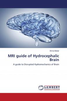 MRI guide of Hydrocephalic Brain