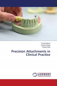 Precision Attachments in Clinical Practice