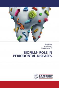 BIOFILM- ROLE IN PERIODONTAL DISEASES