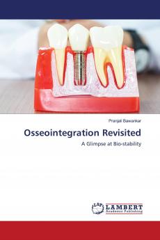 Osseointegration Revisited