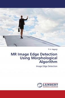 MR Image Edge Detection Using Morphological Algorithm