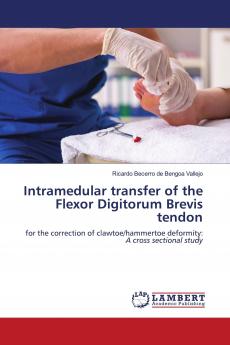 Intramedular transfer of the Flexor Digitorum Brevis tendon